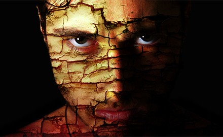 Anger Is Not a Symptom of Bipolar Disorder, Or Is It? Anger Is Not a Symptom of Bipolar Disorder, Or Is It?