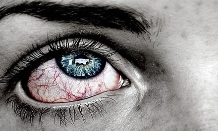 Time It Takes to Recover from Depression after Hypomania Time It Takes to Recover from Depression after Hypomania