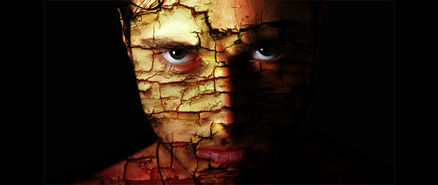 Anger Is Not A Symptom Of Bipolar Disorder Or Is It